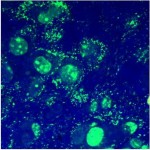Micoplasma DAPI