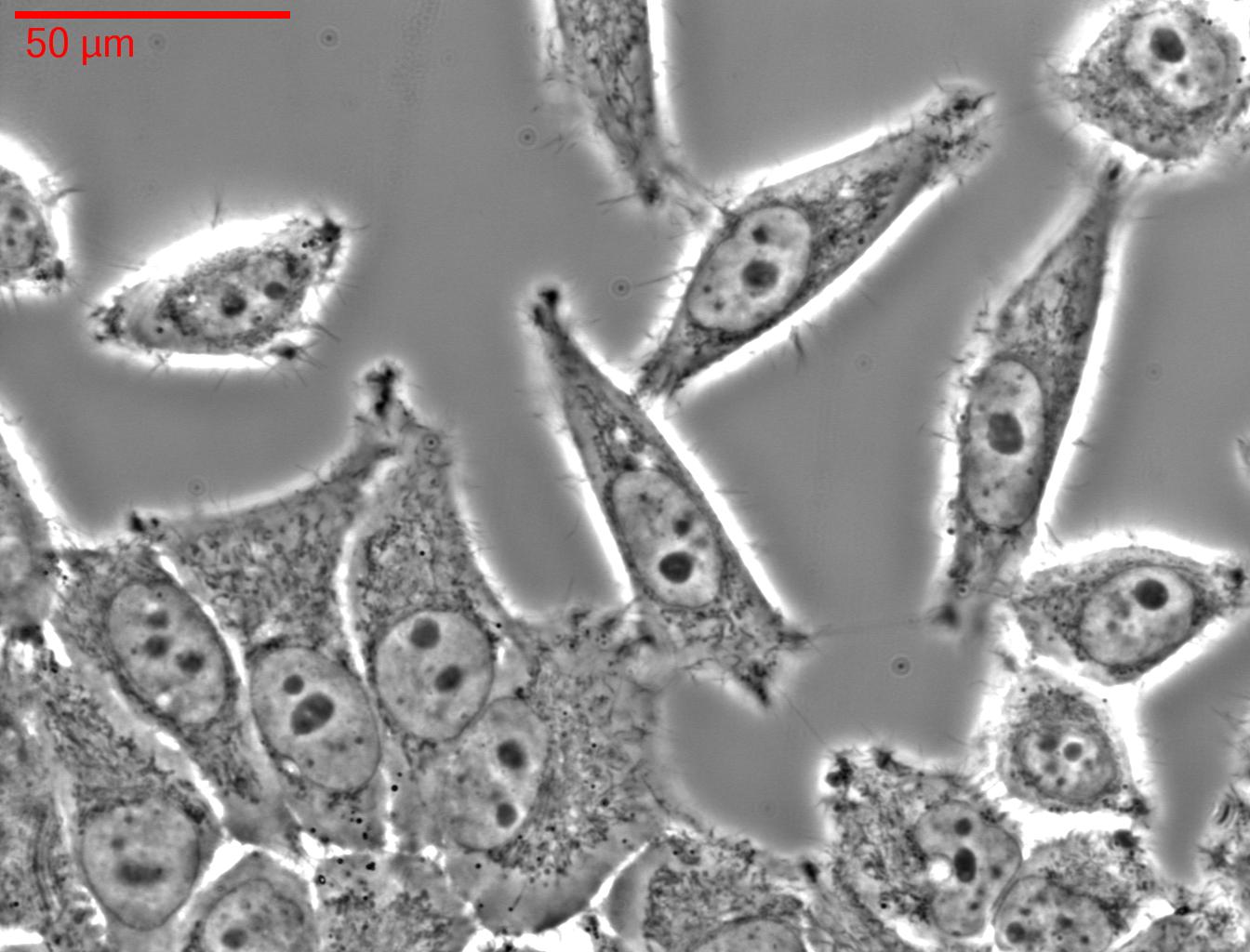 El culebrón de las células HeLa