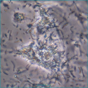 Célula eucariota en un cultivo celular contaminado por bacterias