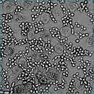 Contaminación por levaduras en cultivo celular