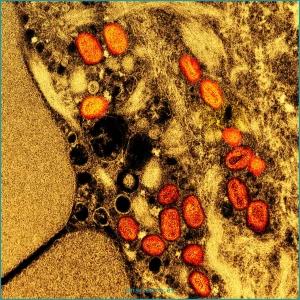 Contaminaciones por virus en cultivo celular