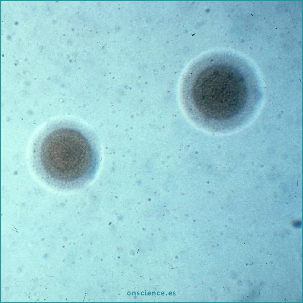 Contaminación por micoplasma en cultivos celulares en laboratorio